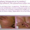 S101-aftokolito-soutien-s44 S101 Αυτοκόλλητο Σουτιέν Σιλικόνης strapless για φόρεμα χωρίς πλάτη